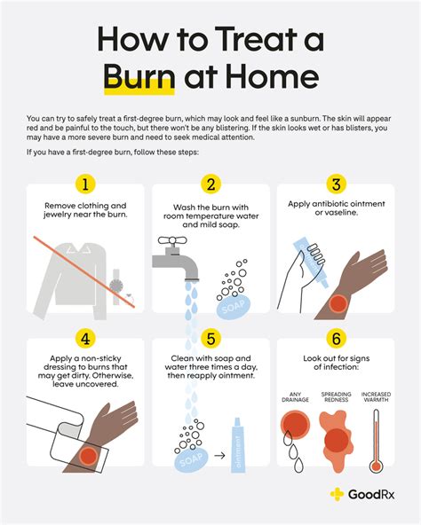 How to Treat a Burn at Home: A Step-by-Step Guide - GoodRx