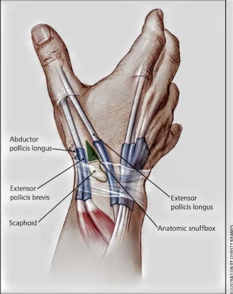 Anatomical snuff box - PT Master Guide