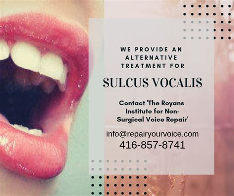 Voice Repair article: You got Diagnosed with Sulcus Vocalis… Now What ...