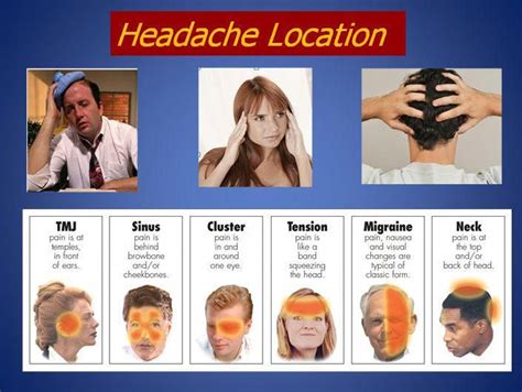 Headache Chart #migraineinfographics | Headache location, Headache chart, Headache