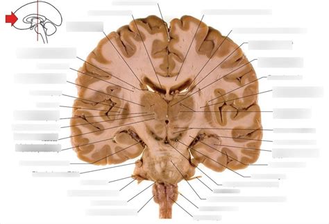 The rostral surface of a coronal section of brain through caudal parts ...