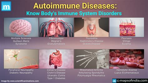 Autoimmune Diseases: Know Body’s Immune System Disorders - Bacteria