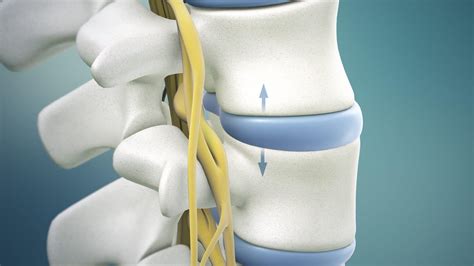 Intersegmental Traction | Spinal Decompression | Back Pain