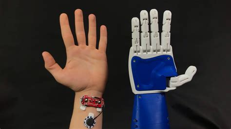 Animatronic 3D Printed Robotic Prosthetic Hand Controlled via EMG - YouTube