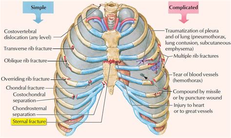 Sternum - Anatomy, Fracture, Pain and Location