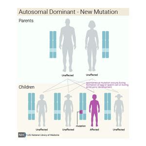 Van der Woude Syndrome | Cincinnati Children's