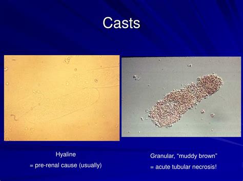 PPT - Acute Renal Failure PowerPoint Presentation, free download - ID:283595