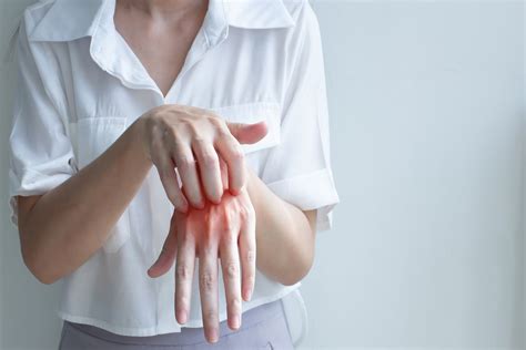 Fungal Skin Infections: Types, Treatment, and Prevention - Verywell Health