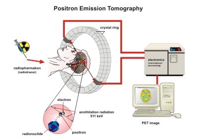 Assignment 1:3 Definitions – Radiotracer – English 301 99A Technical Writing