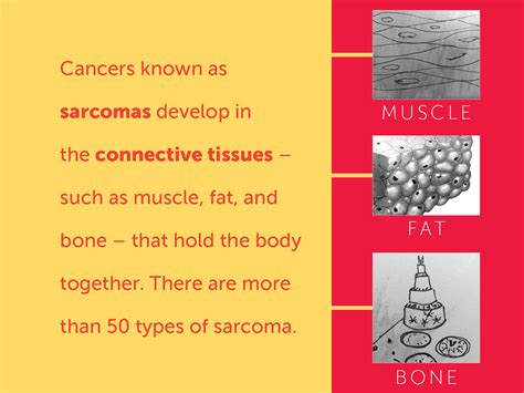 Signs and Symptoms of Soft Tissue Sarcomas | Dana-Farber Cancer Institute