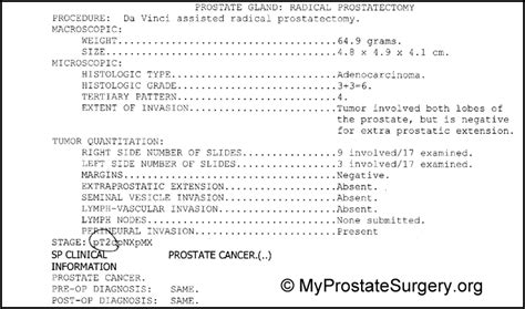 Prostate Biopsy: The Suprising Truth About How 2 Biopsies Can Be So ...