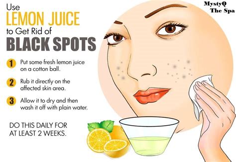 Use #Lemon Juice to Remove Dark spots #Skincare #Beauty #women #fitness #Health #DailyHealthTips ...
