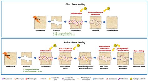 IJMS | Free Full-Text | Hydrogen Sulfide in Bone Tissue Regeneration ...