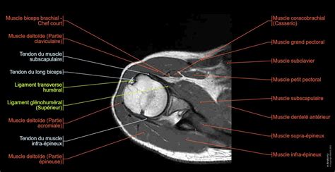 IRM de l'épaule : anatomie normale | e-Anatomy