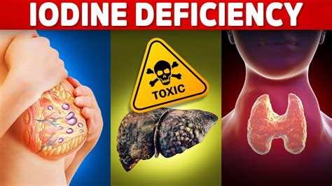 The 5 Signs And Symptoms Of An Iodine Deficiency You've Never Heard