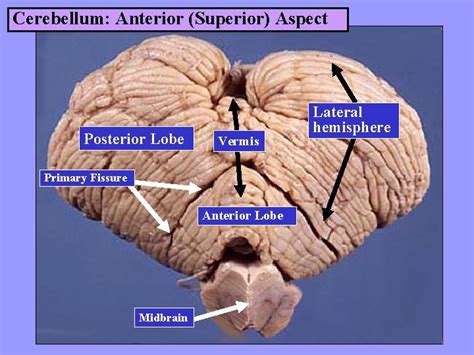 GROSS ANATOMY OF THE BRAIN Dr G R