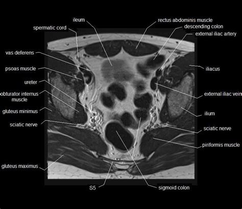 Pelvic Muscle Anatomy Mri