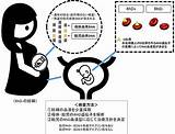 胎児RhD血液型を判定、新たな出生前胎児遺伝学的検査を開発－成育医療センターら  QLifePro 医療ニュース sketch template