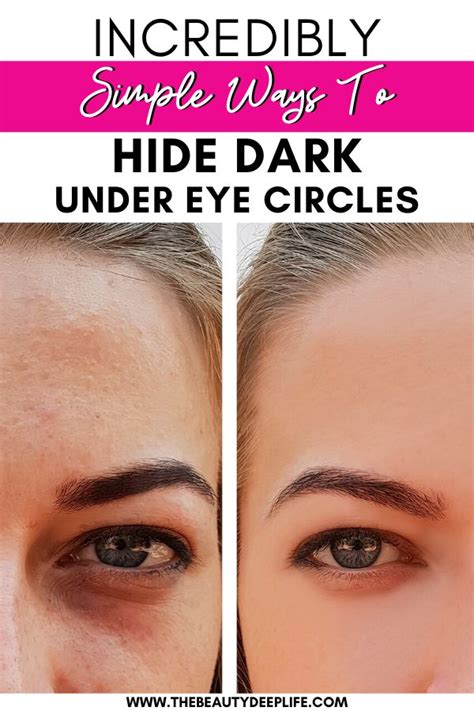 Incredibly Simple Ways To Hide Dark Circles | Dark circles makeup, Dark ...