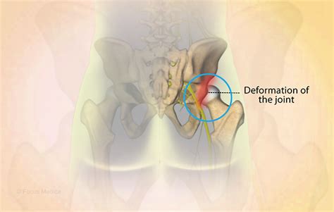 Health Condition : Symptoms, Causes, Treatment and More