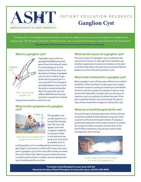 (PDF) PATIENT EDUCATION RESOURCE Ganglion Cyst - … Cyst... · called a “Bible Bump” because ...