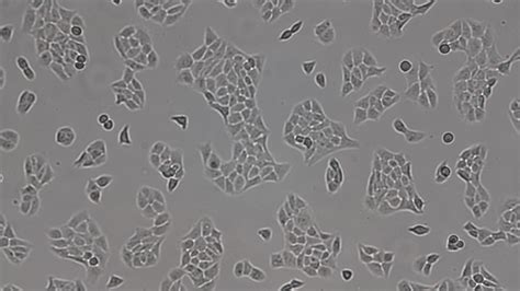 HaCat secretion of black dots after culture from stock?