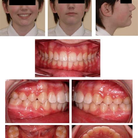 Post-treatment clinical photographs. | Download Scientific Diagram