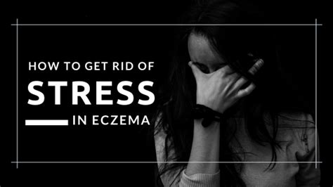 Stress Management Techniques to Control Eczema | Eczemaless