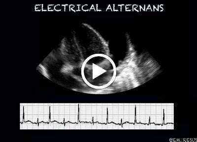 Dr.Nabil Paktin's Journal of Cardiovascular Medicine Blog ژورنال ( قلب و رگ) دکتور نبــیل ...