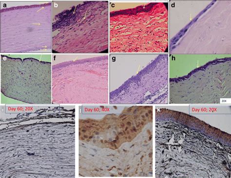 Evaluation of corneal histology after MSC transplantation. H&E staining... | Download Scientific ...