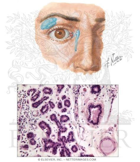 Lacrimal Gland