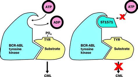 STI571: an inhibitor of the BCR-ABL tyrosine kinase for the treatment of chronic myelogenous ...