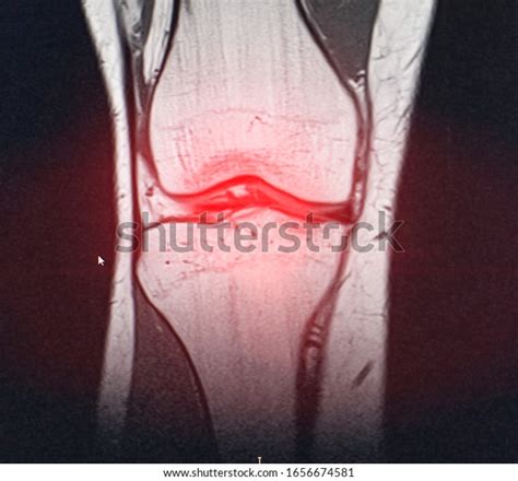 25,813 Muscle X Ray Images, Stock Photos, 3D objects, & Vectors | Shutterstock