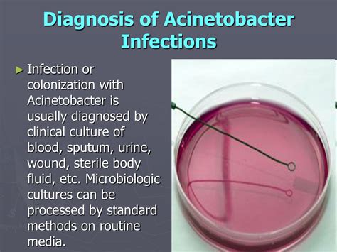 PPT - Acinetobacter baumannii PowerPoint Presentation, free download ...