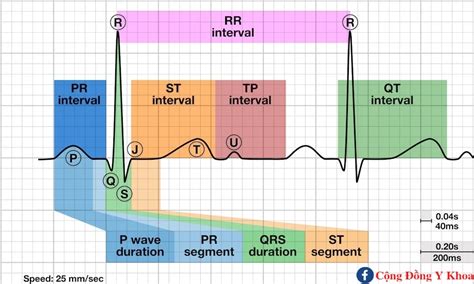 Phức bộ QRS trên ECG | YKHOA247.com