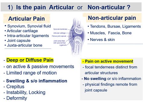 Approach to A Case of Joint Pain - CME INDIA