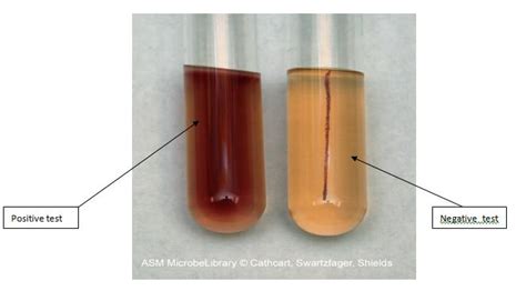 Protocol For Motility, H2S Production & Indole Tests ~ Dhiraj's Blog