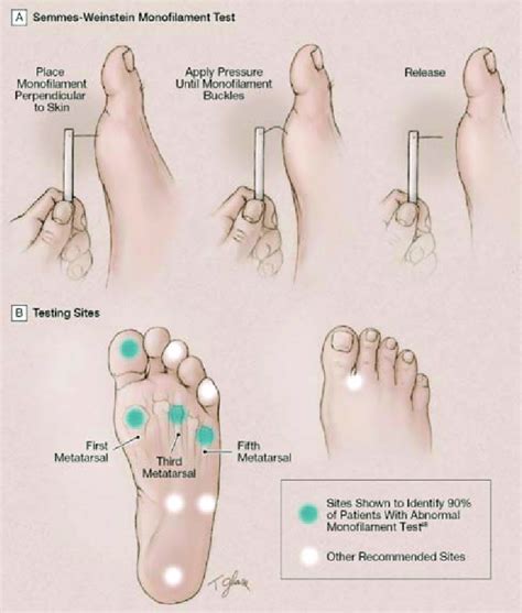 The Components Of A Clinical Foot Exam — Diabetes Management Resources ...