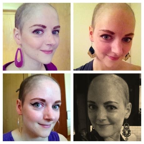 Chemotherapy Hair Loss Timeline