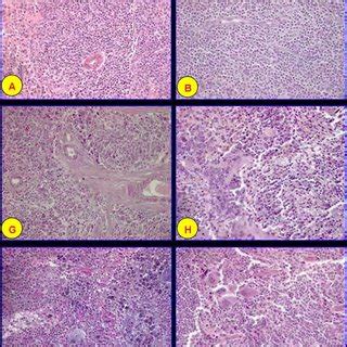 Photographs of nitrogen mustards and sulphur mustard exposed female ...