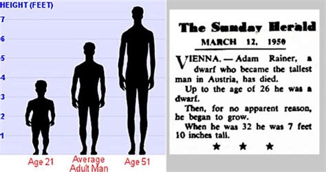 Born A Dwarf And Died A Giant — The Tragic Story Of Adam Rainer | Vintage News Daily