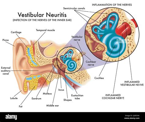 Neuronite vestibulaire Banque de photographies et d’images à haute résolution - Alamy