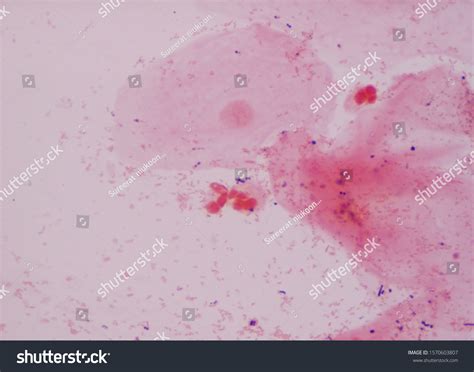 Gram Stain Epithelail Cells Polymorphonuclear Cells Stock Photo ...