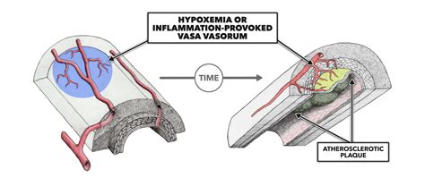 CrossFit | The Vasa Vasorum