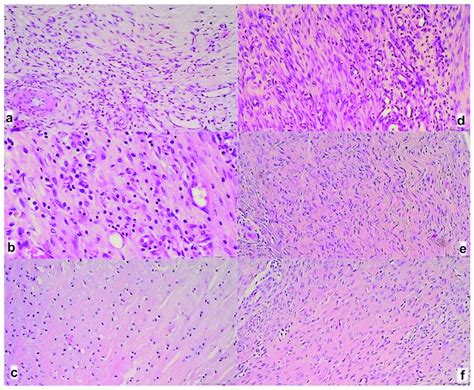 A myotendinous junction area in control (a-c) and BPC 157 treated rats... | Download Scientific ...