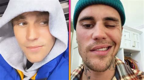 Justin Bieber Shows Off Facial Paralysis Recovery Progress - YouTube