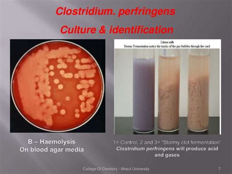 Clostridium species - Microbiology