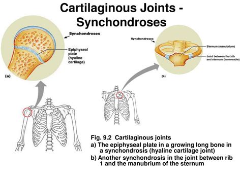 PPT - Joints Bone Connections PowerPoint Presentation - ID:176707