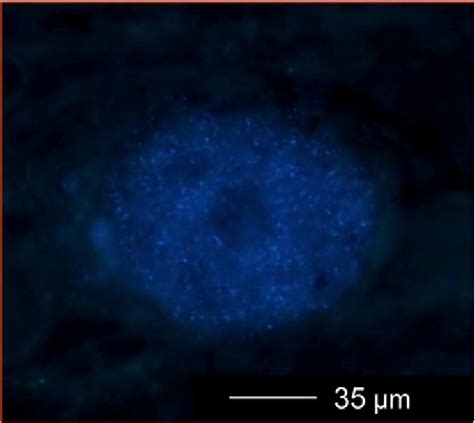 Micrograph showing a labelled pseudounipolar neuron of the left ...