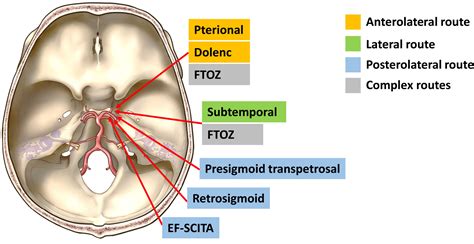 Frontiers | Endoscopic far-lateral supracerebellar infratentorial approach for resection of ...